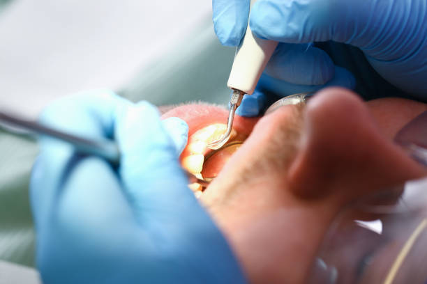 Best Tooth Infection Emergency Dentist  in Hiram, GA
