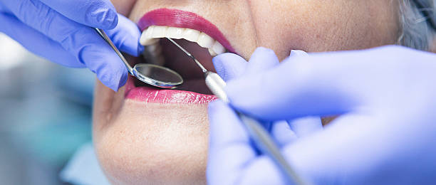 Best Knocked-Out Tooth Emergency  in Hiram, GA